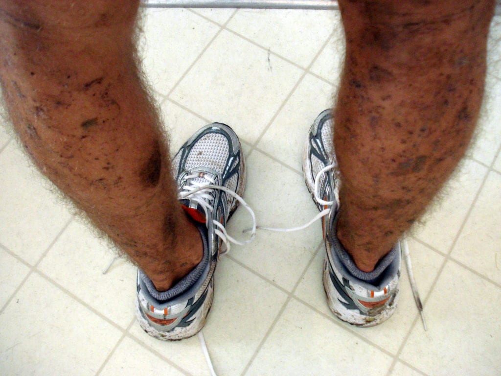 dirty legs photo 1024x768